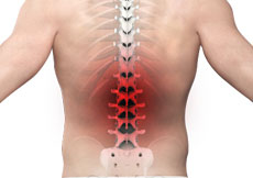 Back Pain