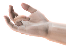 Dupuytren’s Contracture