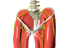 Muscle Strains