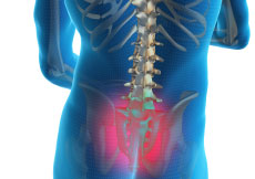 Sacroiliac Joint Dysfunction