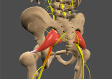 Sciatica
